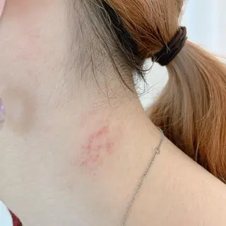 Orefine33（オリファインサンサン）所属・Orefine33 オリファインサンサンのエステ・リラクイメージ