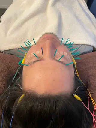 美容鍼　蒼月-aotsuki-所属・美容鍼「蒼月」 -アオツキ-のエステ・リラクイメージ