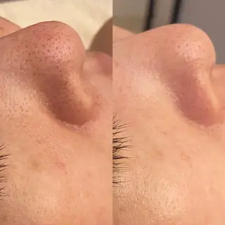 hm NATURESKINのエステ・リラクイメージ