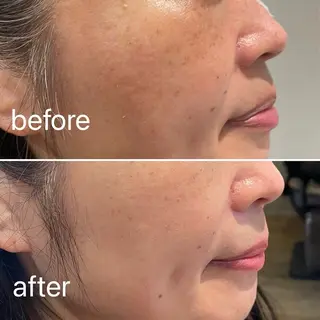 痛くないシミ取り 【荻窪】石橋のヘアスタイル