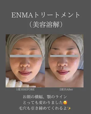 BLOSSOM 菊地のエステ・リラクイメージ