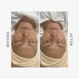 東海エリア1位受賞 長江香保のエステ・リラクイメージ