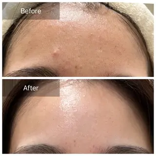 毛穴が見えなくなるサロン  Horo所属・岡 えり子のエステ・リラクイメージ