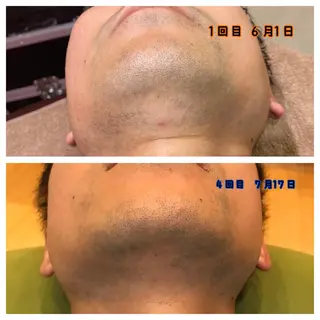 メンズ ヘアメイクアース 上村のエステ・リラクイメージ