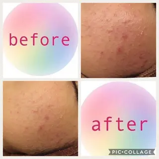 ミディアム カラー パーマ ヘアアレンジ メンズ キッズ ネイル マツエク・マツパ ニキビ・肌質改善専門 ♡人生が変わるサロンのエステ・リラクイメージ