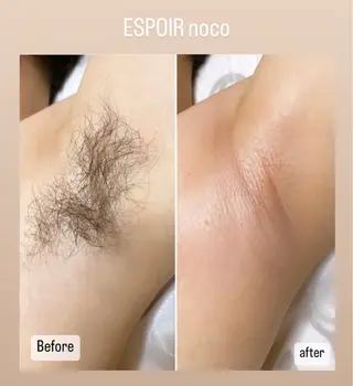 ワックス脱毛🌈 ESPOIRnocoのエステ・リラクイメージ