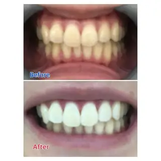 M渋谷店所属・M渋谷 ホワイトニングのエステ・リラクイメージ