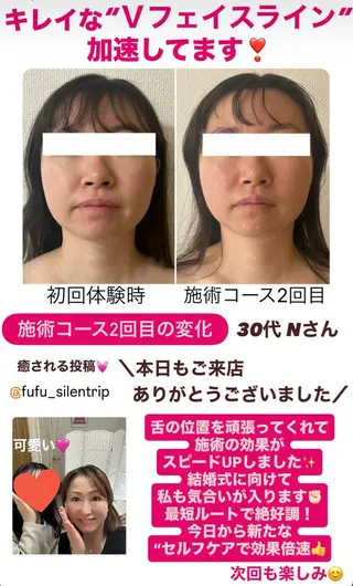 la lumie're (ラ リュミエール)所属・小顔サロン (ラ リュミエール)のエステ・リラクイメージ