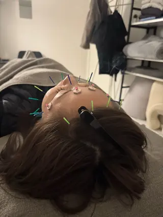 美容鍼×小顔矯正 ×美容整体　浜川泰仁のエステ・リラクイメージ