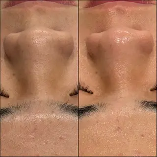 LiZA エステティックサロンのエステ・リラクイメージ