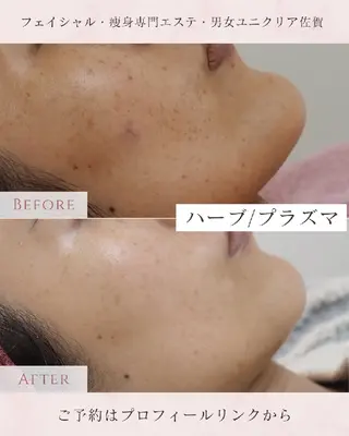 ユニセックスエステサロンUniclear所属・痩身&フェイシャル Uniclearのエステ・リラクイメージ