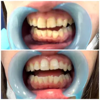 プライベートサロン Lｏｋａｈｉ飯生透のエステ・リラクイメージ