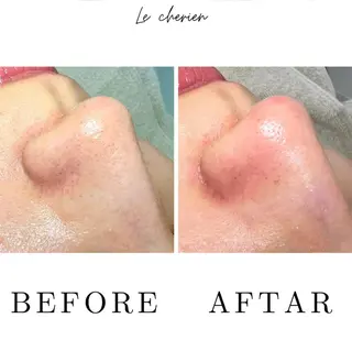 Le  cherien ル シェリア所属・毛穴洗浄/ハイフ サロンのエステ・リラクイメージ