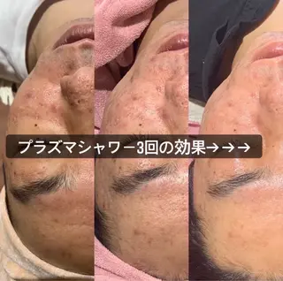 EARTH coiffure beaute 小山店所属・EARTH 小山店 shimaのエステ・リラクイメージ