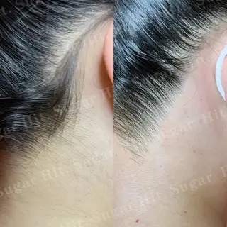 Hit. シュガーリング豊橋のエステ・リラクイメージ