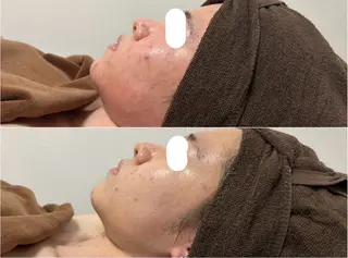 ビューティーサロン　ア・クイーユ所属・ビューティーサロン ア・クイーユのエステ・リラクイメージ