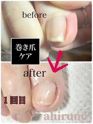 ネイル ａｈｉｒｕｎｏ ✿ ｙｕiのネイルデザイン