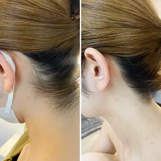 うなじ脱毛/美肌脱毛 LABELのエステ・リラクイメージ