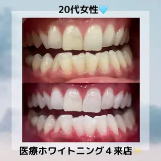 Kaula所属・Kaula ホワイトニング耳ツボのその他イメージ