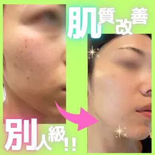 痩身&美肌サロン 遠藤🍊のエステ・リラクイメージ