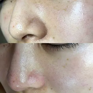 毛穴ケア・ヘッドスパサロンSHINY(シャイニー)所属・毛穴ケア・ヘッドスパ サロンSHINYのエステ・リラクイメージ