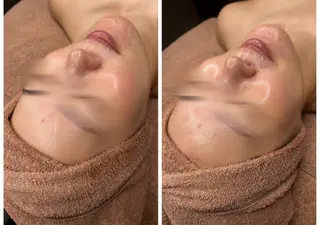 EstheticSalonReTweet所属・竹谷 春希のエステ・リラクイメージ