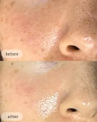 LaVibe ann.のエステ・リラクイメージ