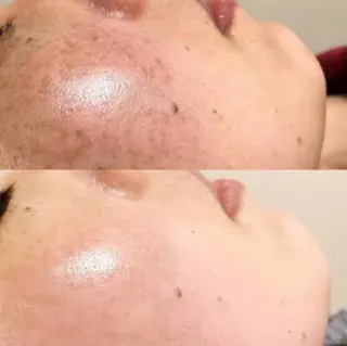 Charme Esbeaute所属・南森町 ｃｅのマツエク・マツパデザイン