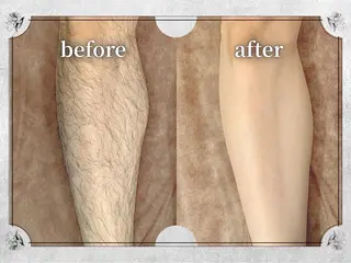 都度払い 脱毛 Lino柏/moeのエステ・リラクイメージ