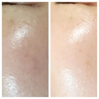 🅖🅤🅩🅔🅛 salonのエステ・リラクイメージ