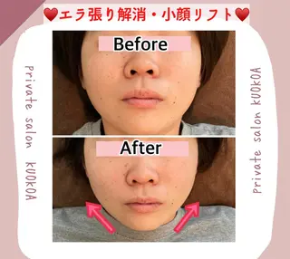 中目黒  整体 小顔 KUOKOAのエステ・リラクイメージ