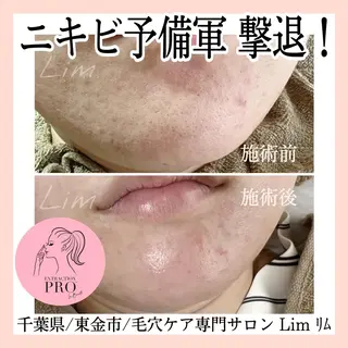 Lim Naomiのマツエク・マツパデザイン