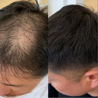 メンズ Blooming所属・LOUISE. ／肌質・頭皮のエステ・リラクイメージ