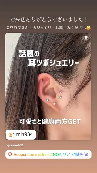 Acupuncture  salon LINOA リノア鍼灸院所属・ヘッドスパ鍼/小顔鍼 耳ツボ 　LINOAのエステ・リラクイメージ
