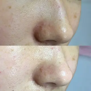 毛穴ケア・ヘッドスパサロンSHINY(シャイニー)所属・毛穴ケア・ヘッドスパ サロンSHINYのエステ・リラクイメージ