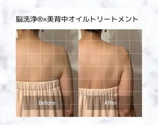 【頭痛、睡眠改善】 salon RUUのエステ・リラクイメージ