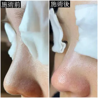 Luralïy hair kitakyushu所属・Luralïy ルーラリーのエステ・リラクイメージ