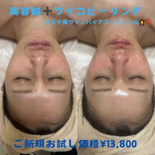 美容鍼灸サロンRemeリミー所属・美容鍼WINBACK サロンRemeのエステ・リラクイメージ