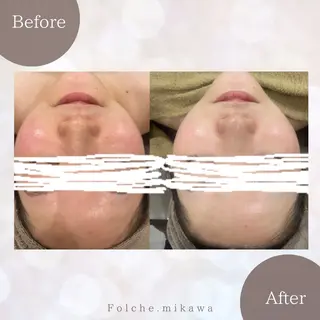 Folche三川町ア ピールポイント確認！のエステ・リラクイメージ