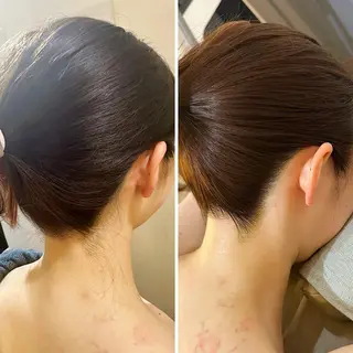 うなじ脱毛/美肌脱毛 LABELのエステ・リラクイメージ