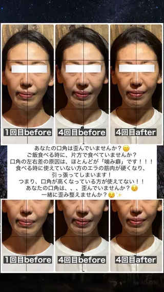 💎後悔させない小顔 矯正💎イトヤマ🌱のエステ・リラクイメージ