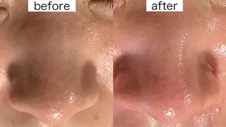 医療提携Beauty SalonMuseのエステ・リラクイメージ