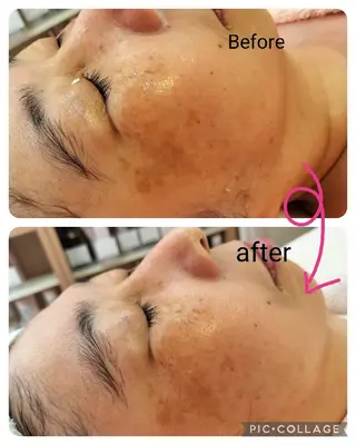 九鬼 瞳のエステ・リラクイメージ