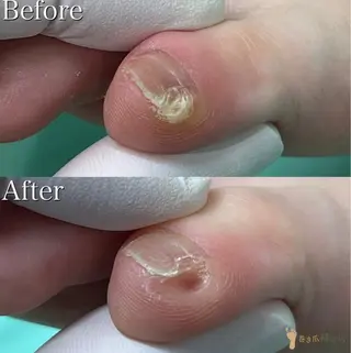 福岡巻き爪補正店 博多店のエステ・リラクイメージ