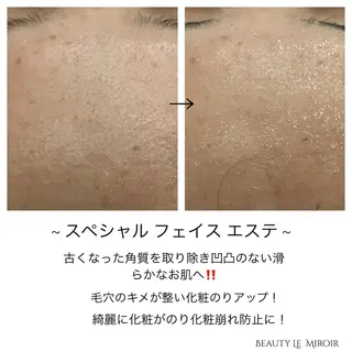 ビューティー ミロワールのエステ・リラクイメージ