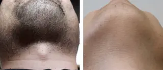 メンズ Beauty Salon AZUL所属・ビューティーサロン AZULのエステ・リラクイメージ