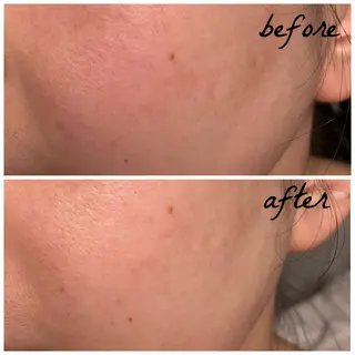 メンズ メナード岐阜市茜部 杉浦のエステ・リラクイメージ