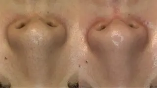 ２月限定‼️モニター 募集LUNEAのエステ・リラクイメージ