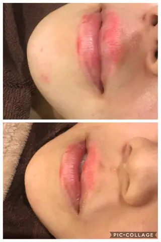 セミロング パーマ ヘアアレンジ ネイル マツエク・マツパ 四つ星サロン🎖 腸＆ニキビケアに特化のエステ・リラクイメージ