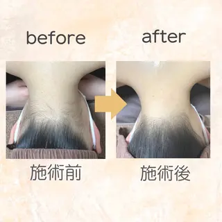 脱毛専門店 Angemのエステ・リラクイメージ